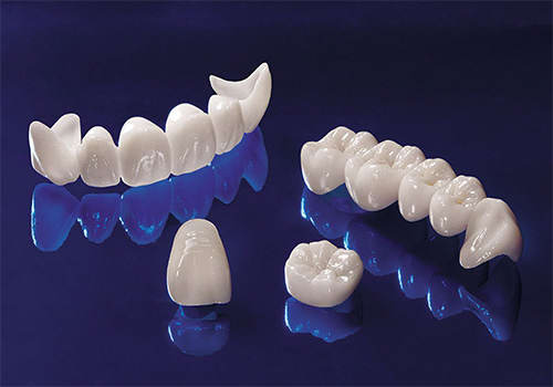Diş Köprüsü Nasıl Yapılır? Eksik Diş Yerine Köprü Tedavisi